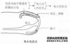 运城龟头阴沟有小痘痘包皮里面发红